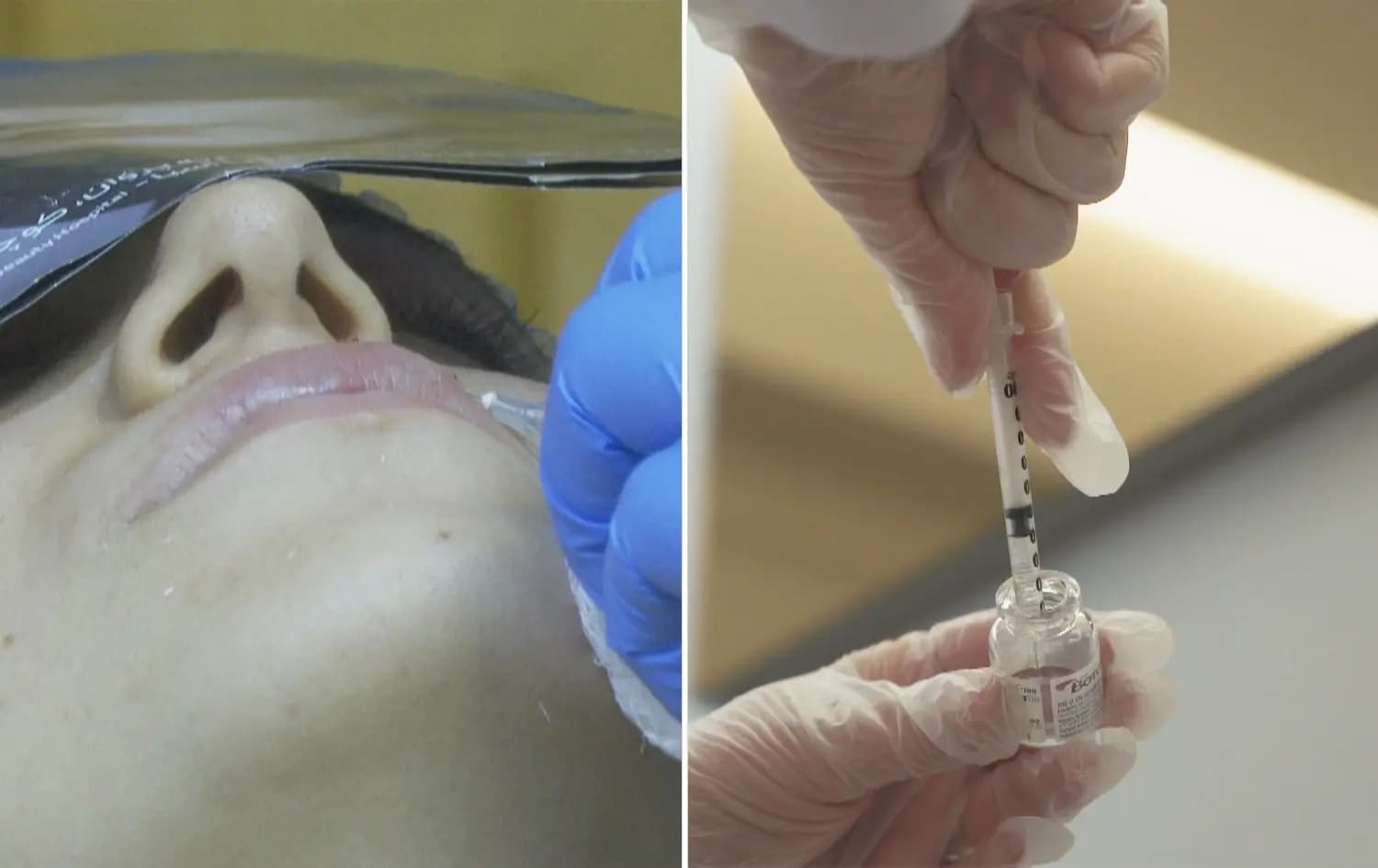 دائرة صحة كركوك: معاقبة 3 - 4 صالونات تجميل أسبوعياً بسبب "الفيلر" و"البوتوكس"